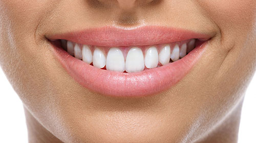 باندینگ دندان چیست و چه فایده ای برای دندان ها دارد؟