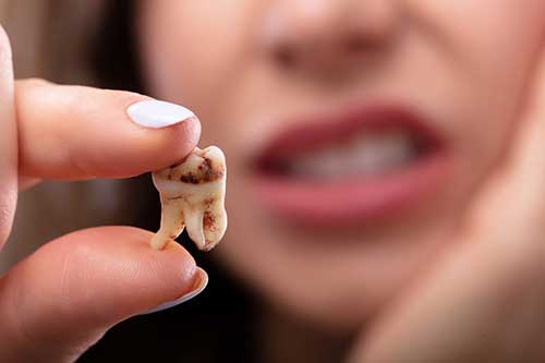 علایم پوسیدگی دندان