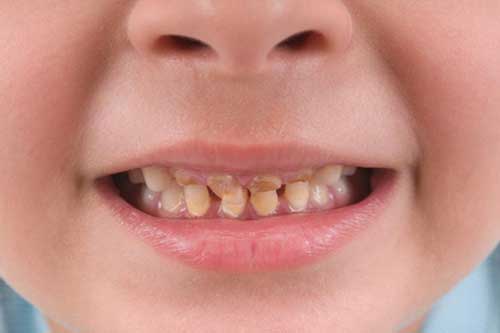 سلامت دندان کودکان