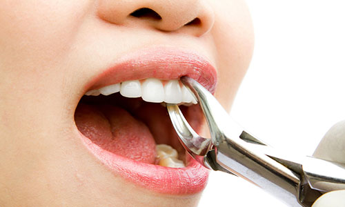 بهبودی پس از کشیدن دندان