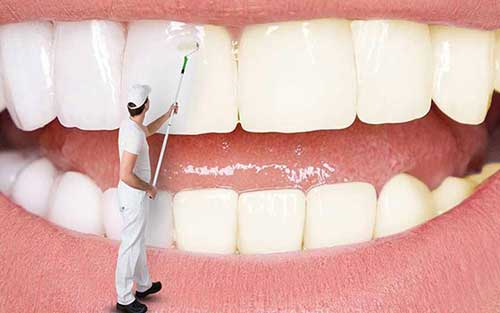 هزینه سفید کردن تخصصی دندان