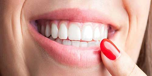 انتخاب تاج دندان برای اصلاح شکل دندان های آسیب دیده