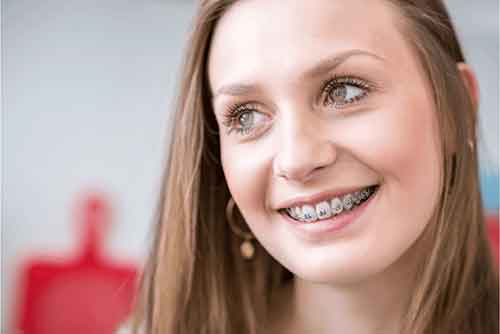 تفاوت ارتودنسی با لیزر و لمینت دندان