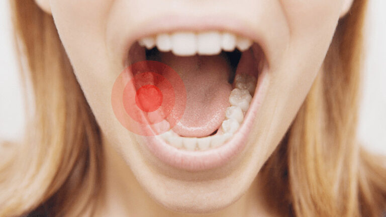پاتولوژی دهان و دندان