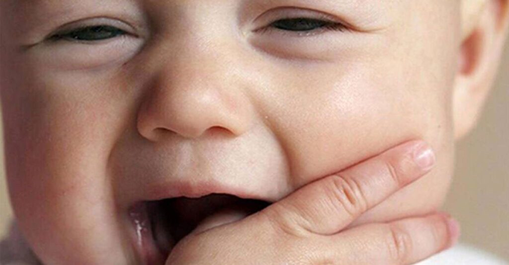 علائم و نشانه‌های رویش دندان‌های شیری در کودکان